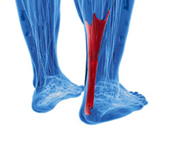 Calf Muscles and Running: Injury and Care
